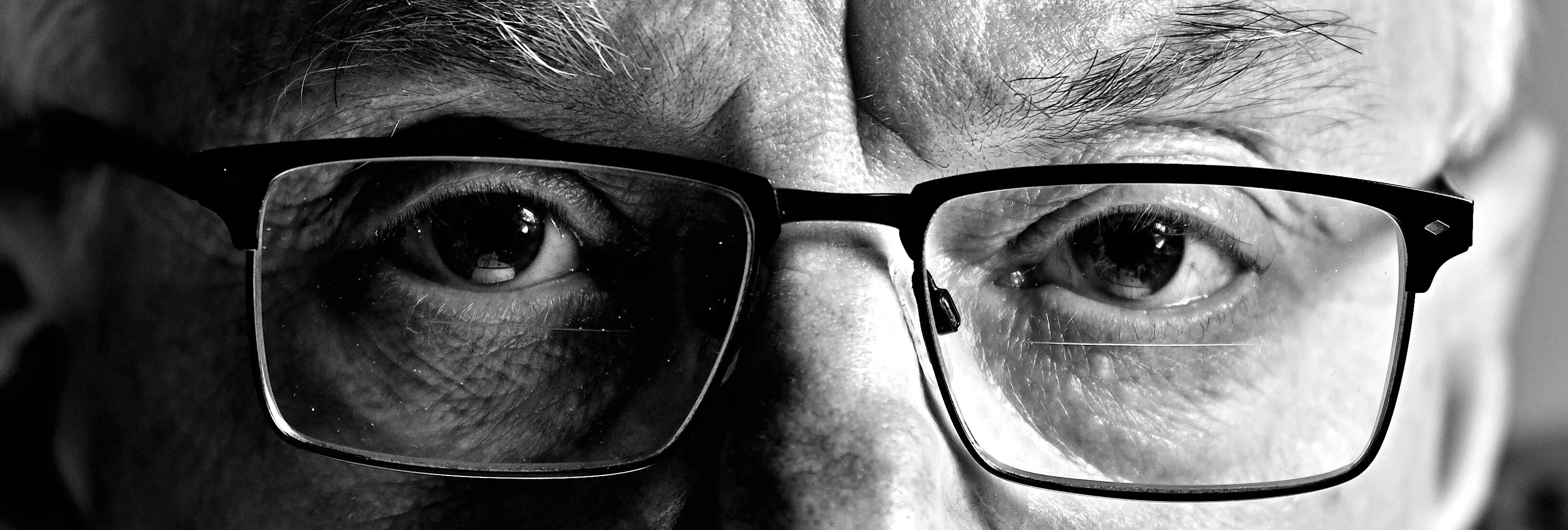 The 'eyes' have it -through the lens darkly.