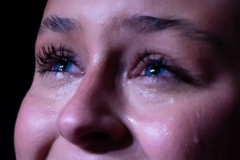 Teary eyes