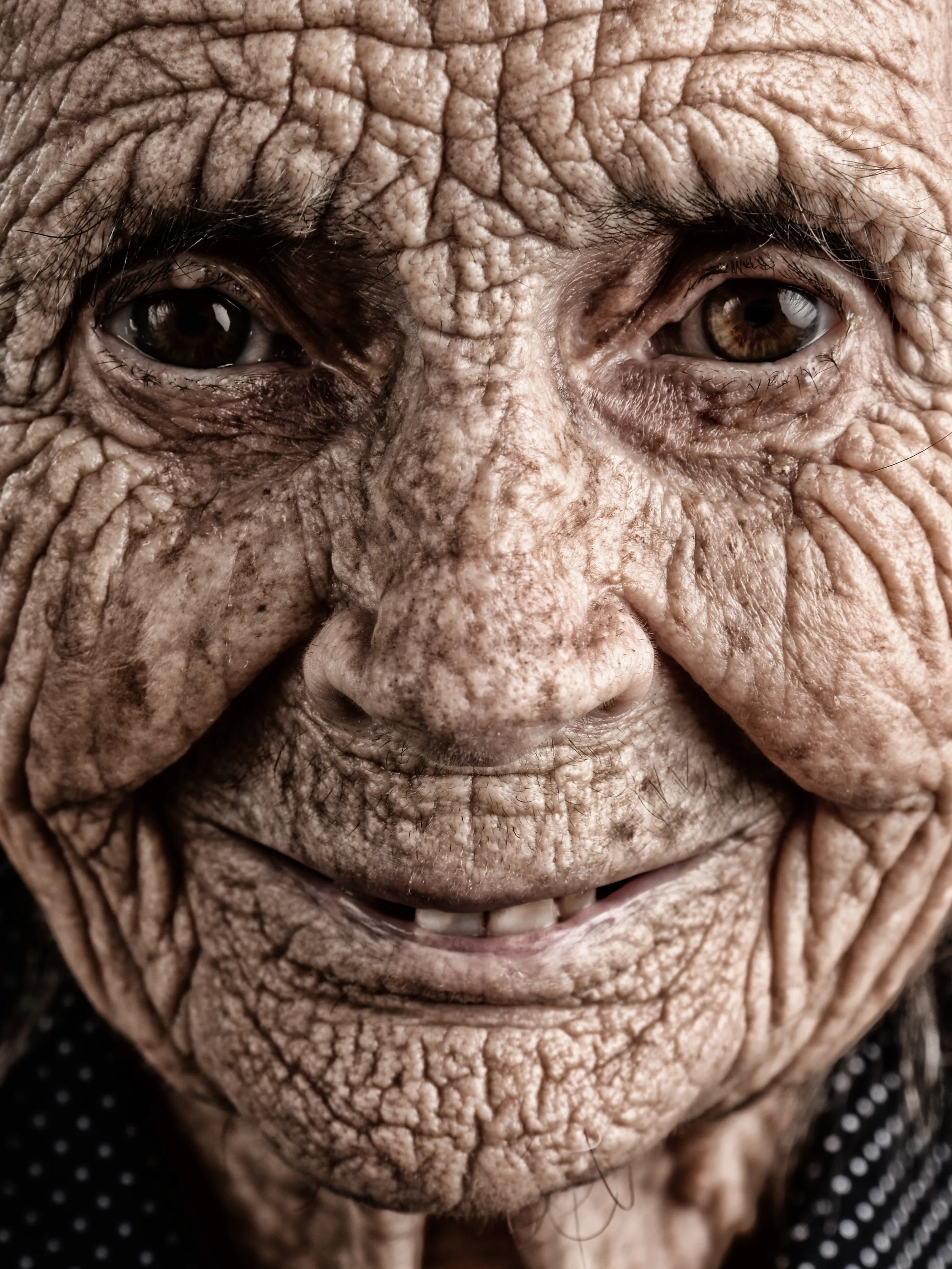 deep wrinkles