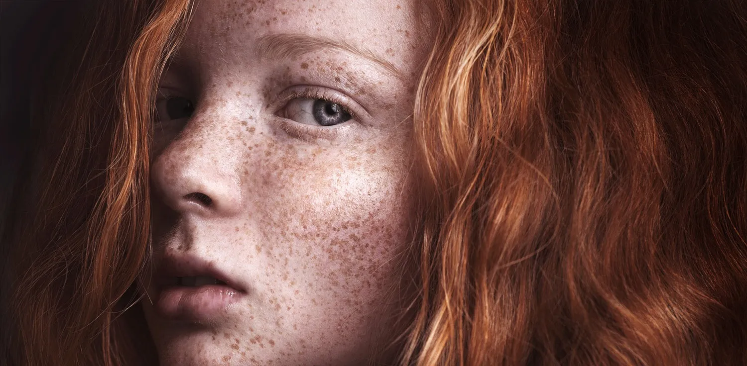 Redheads