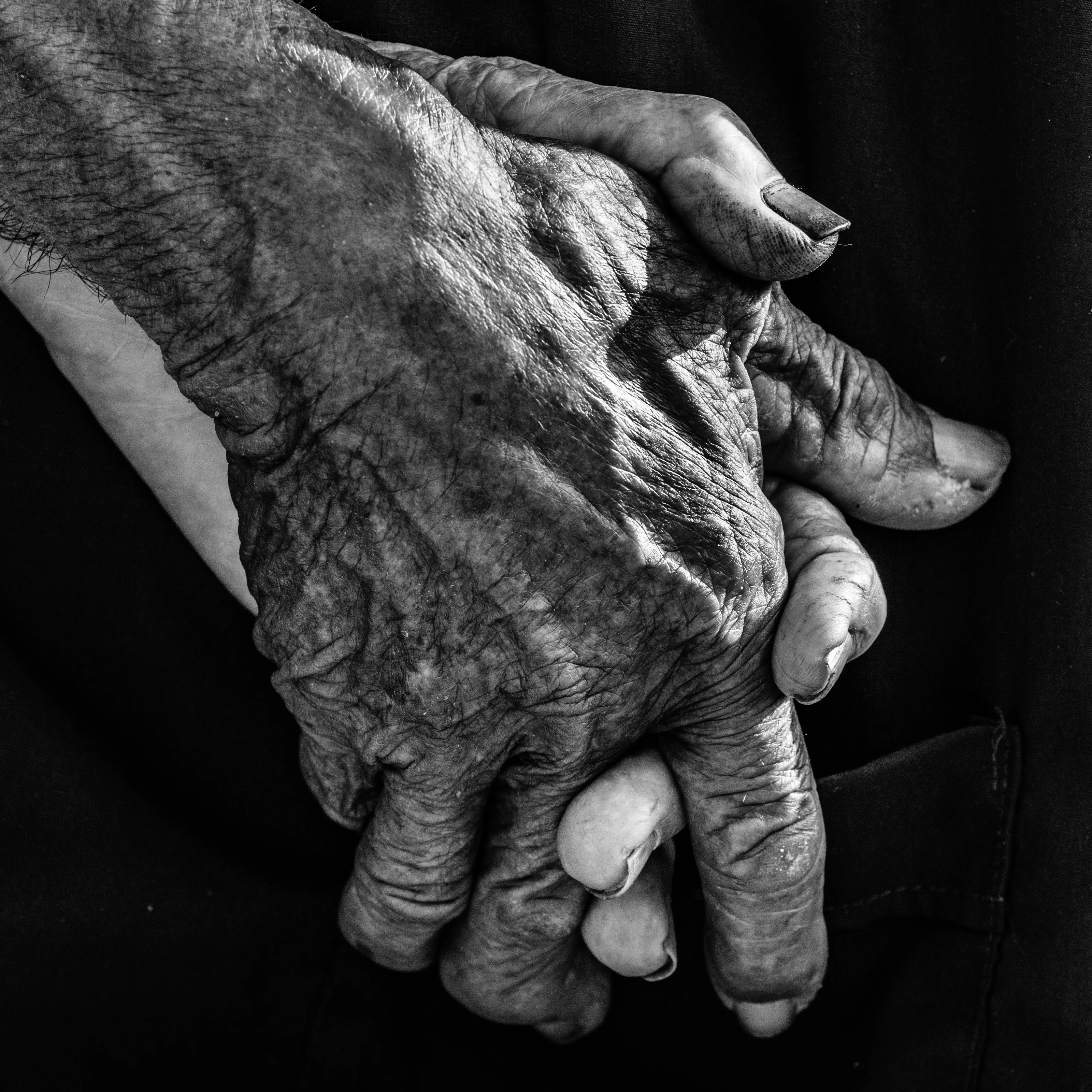 Hands or feet