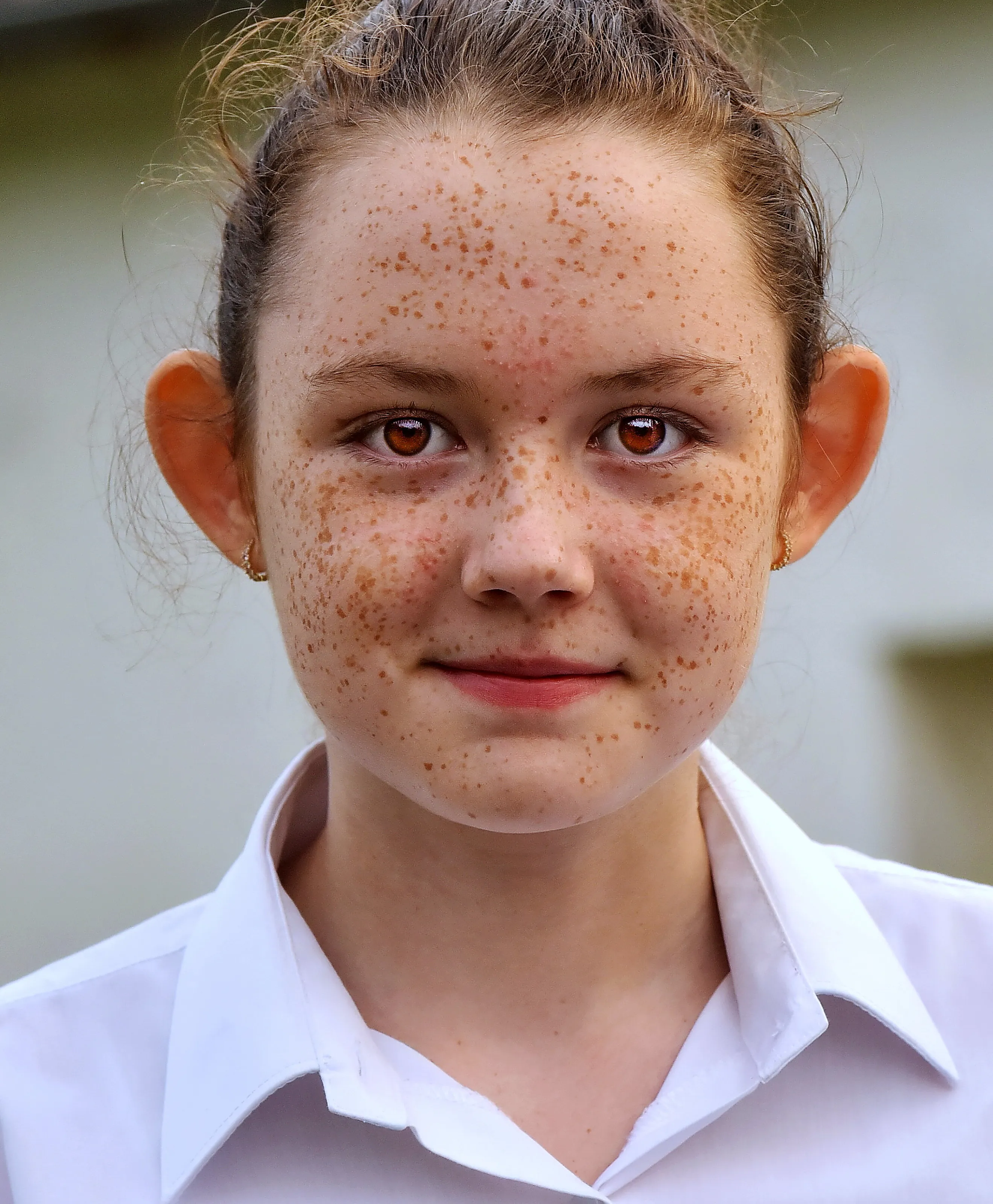 Freckled girl