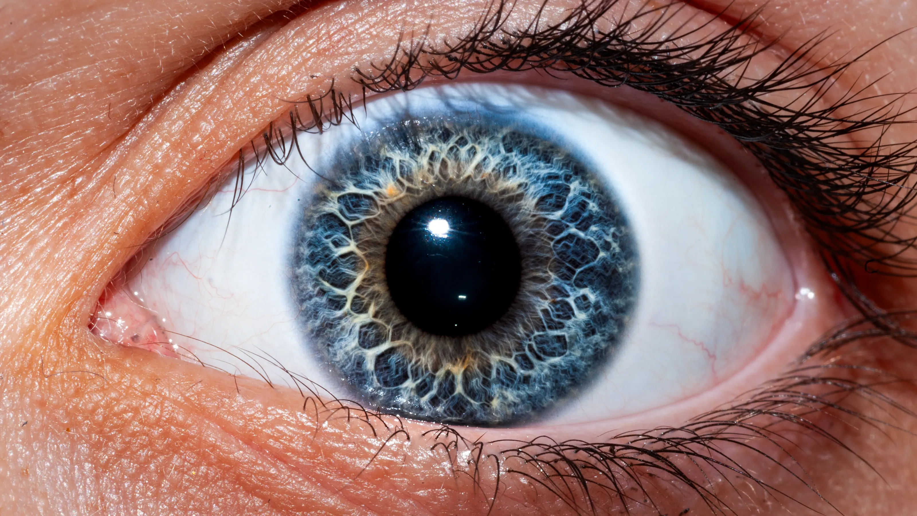 Ocular Tempest
