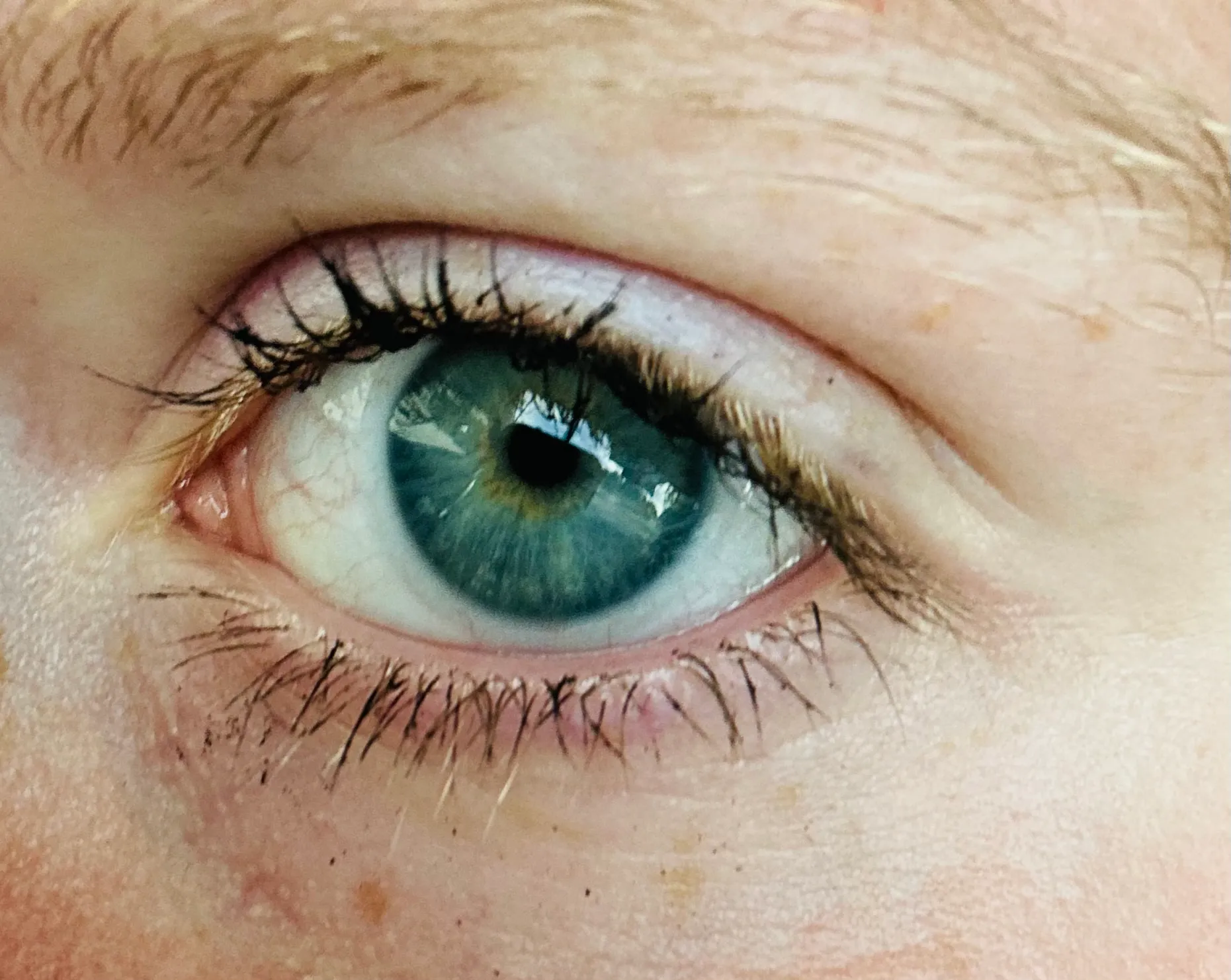Perfect Imperfections