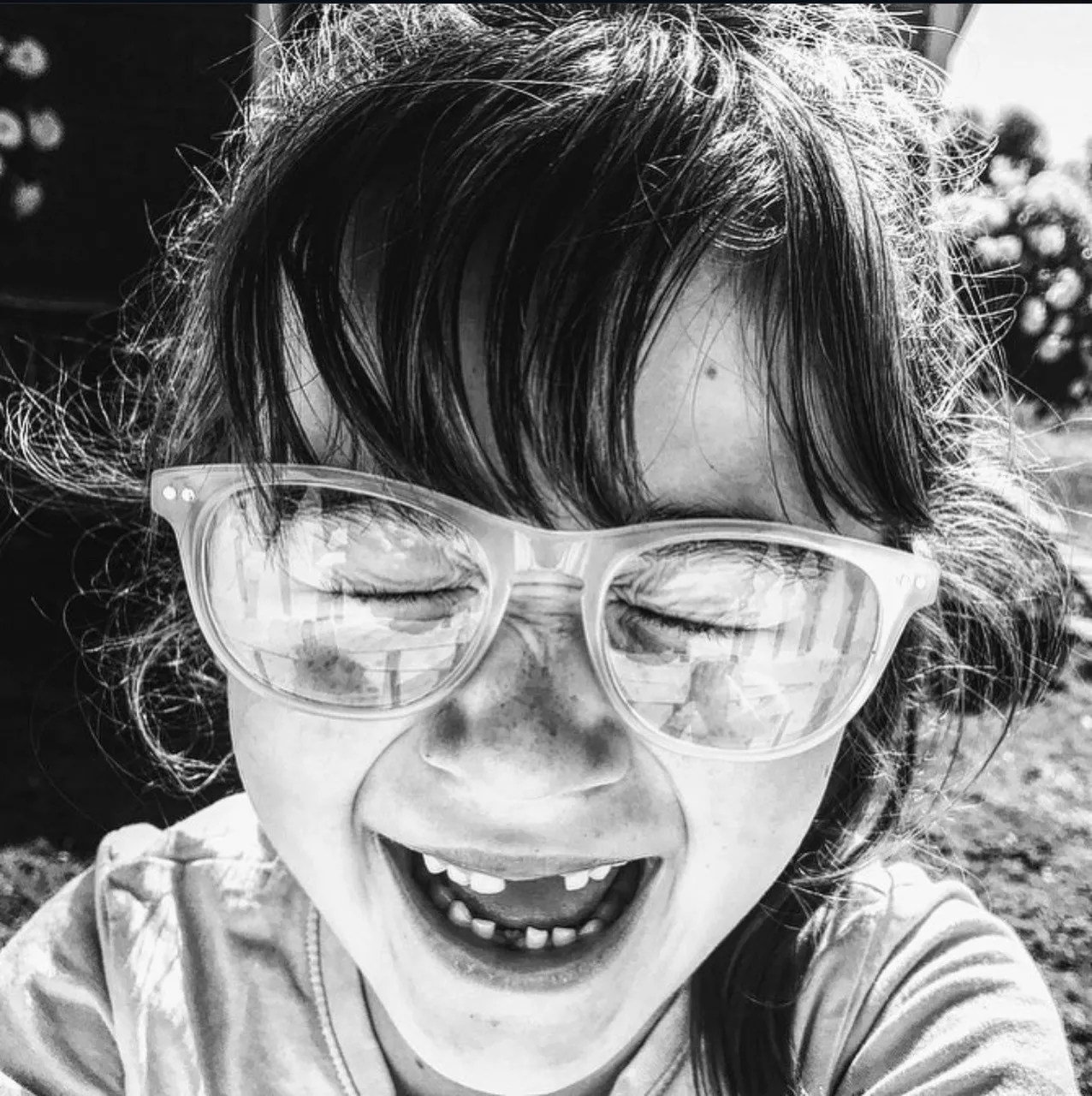 Missing teeth