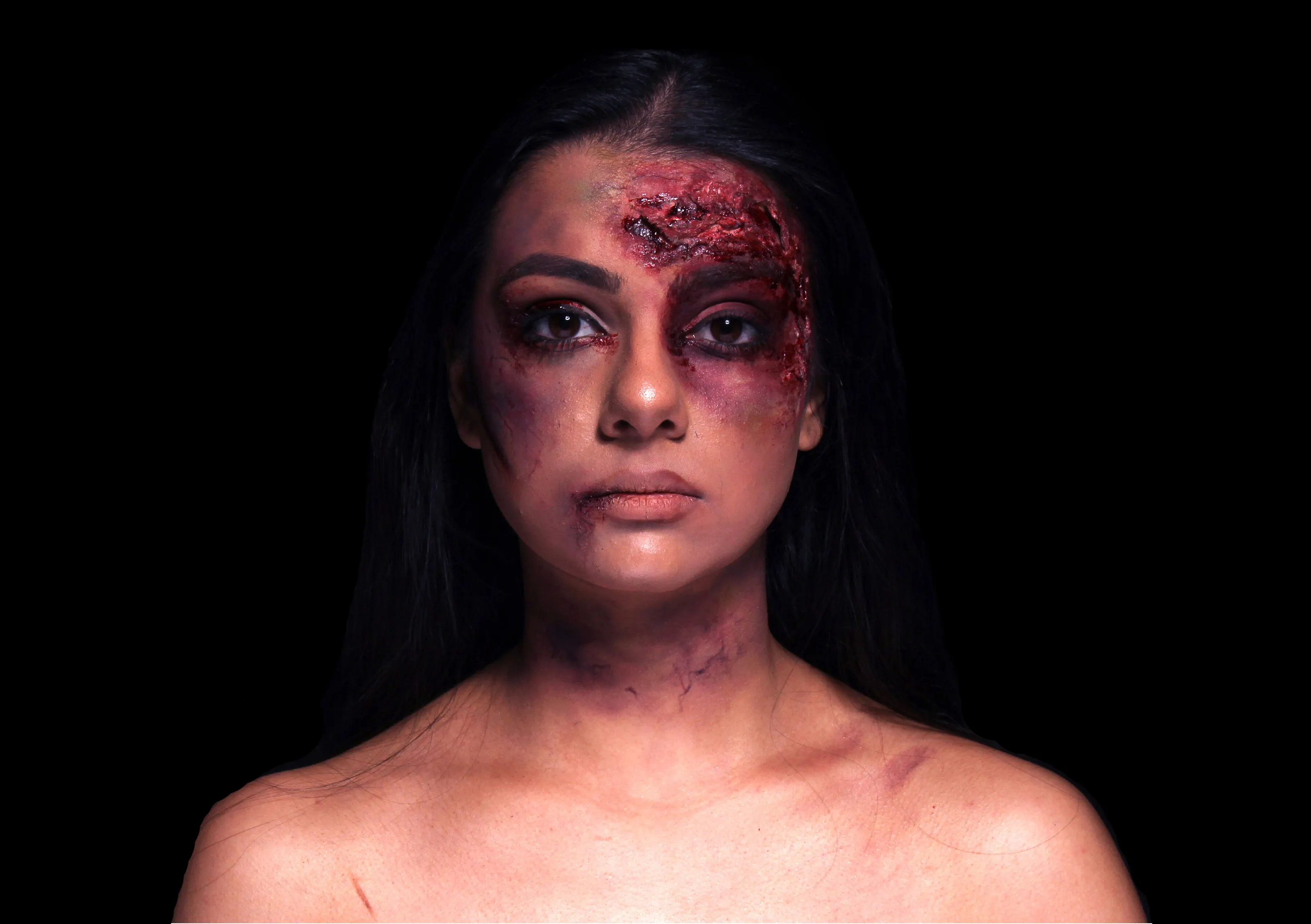 Love Hurts