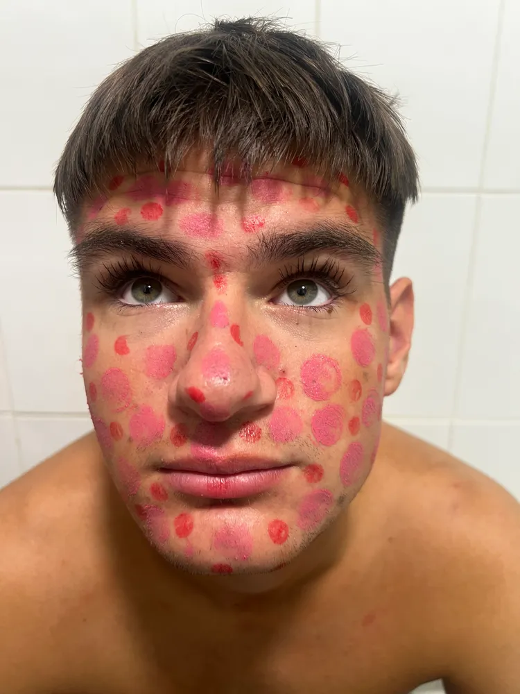 Dots.