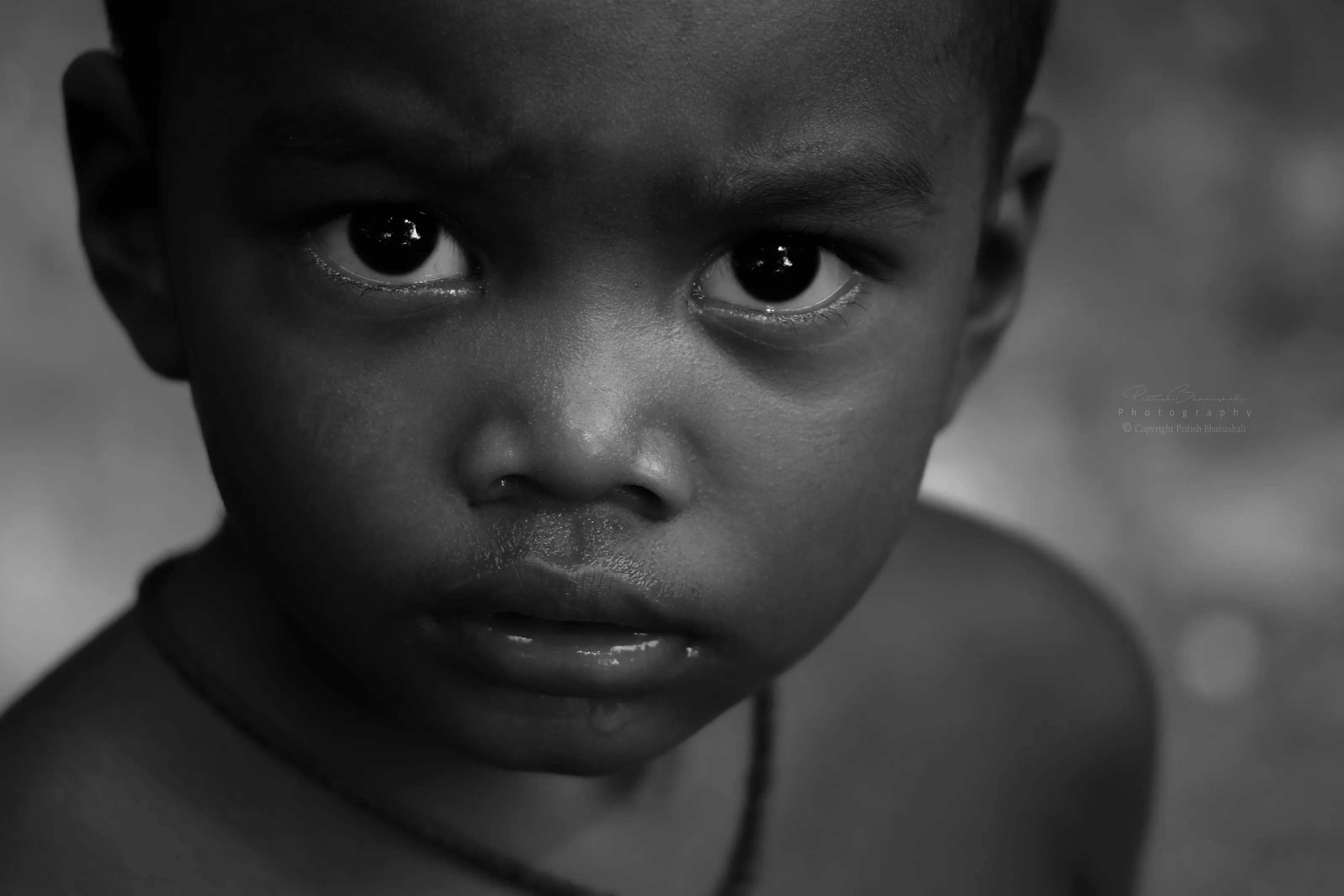 The Eyes