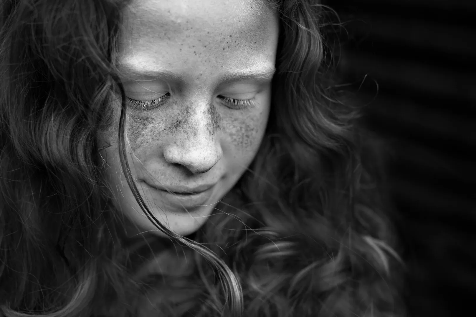 Freckles