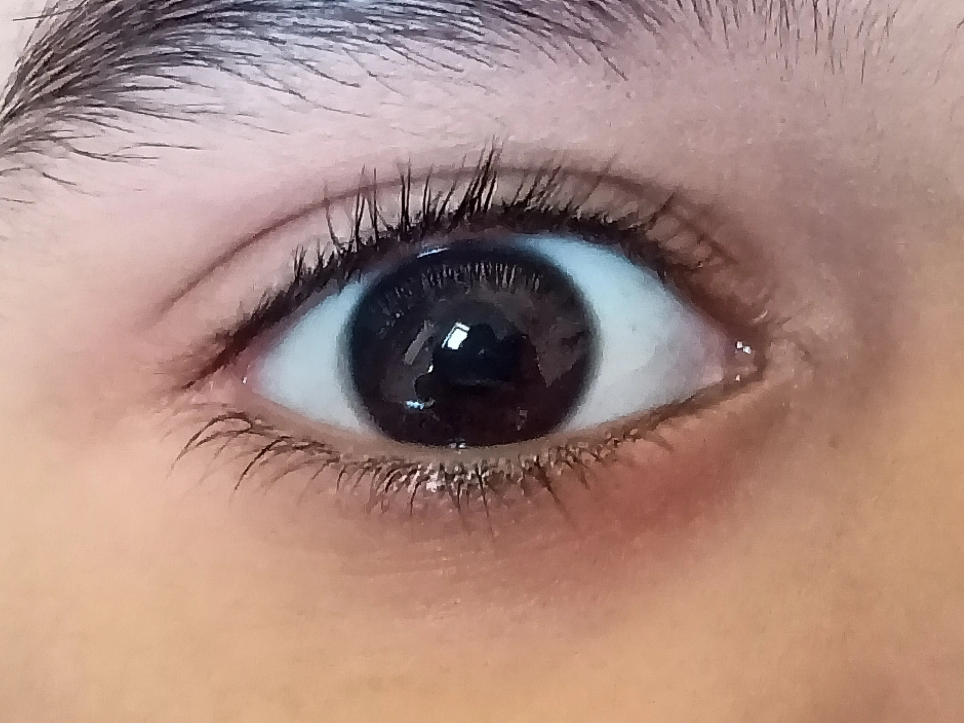 Focus on Eye