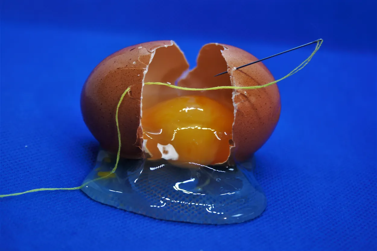 Stiching egg