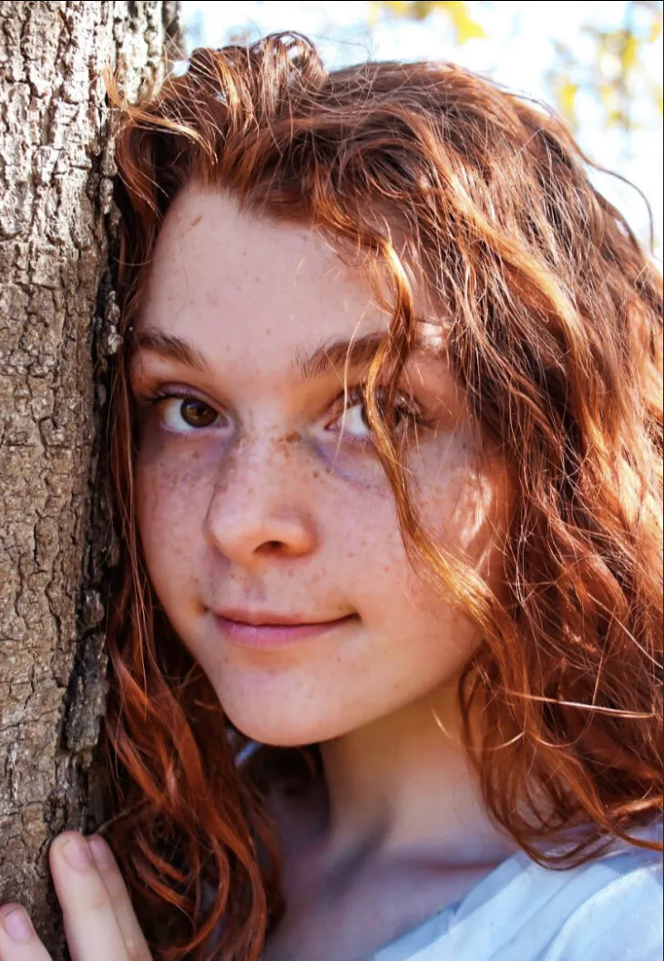 Freckles and red hair